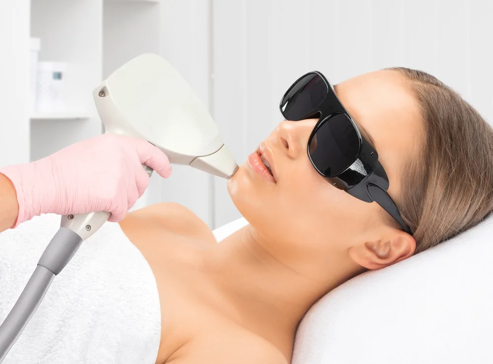 IPL Laser Treatment